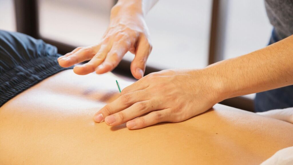 Acupuncture for stress