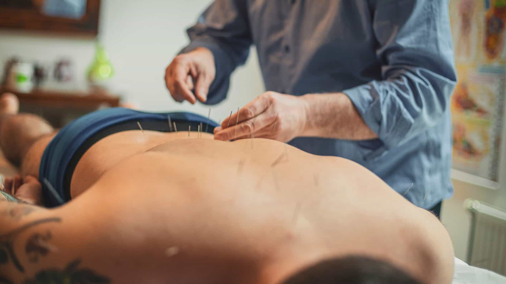 Acupuncture For Pain Relief Benefits