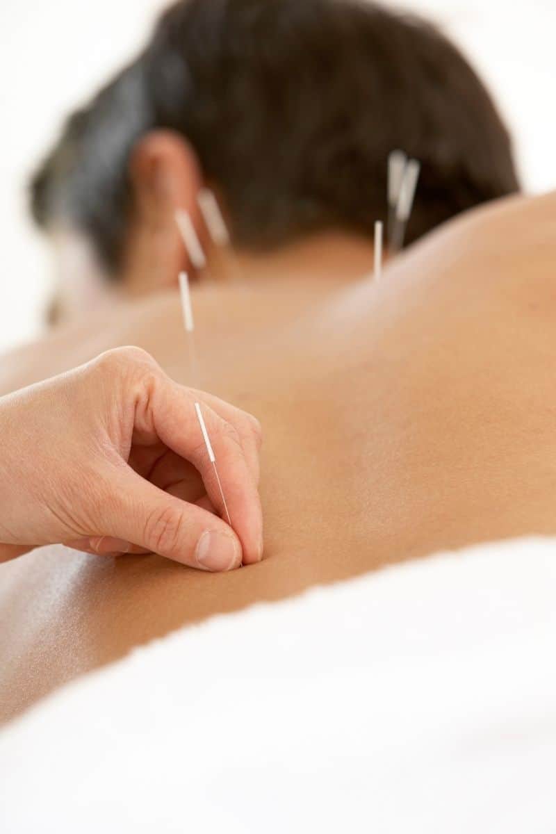 Acupuncture For Stress & Anxiety Summary