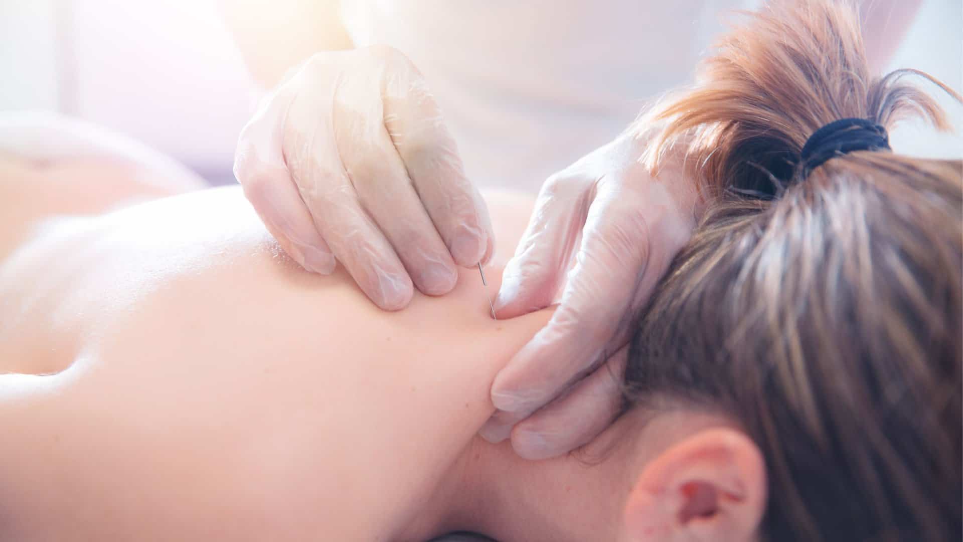 Acupuncture For Stress & Anxiety