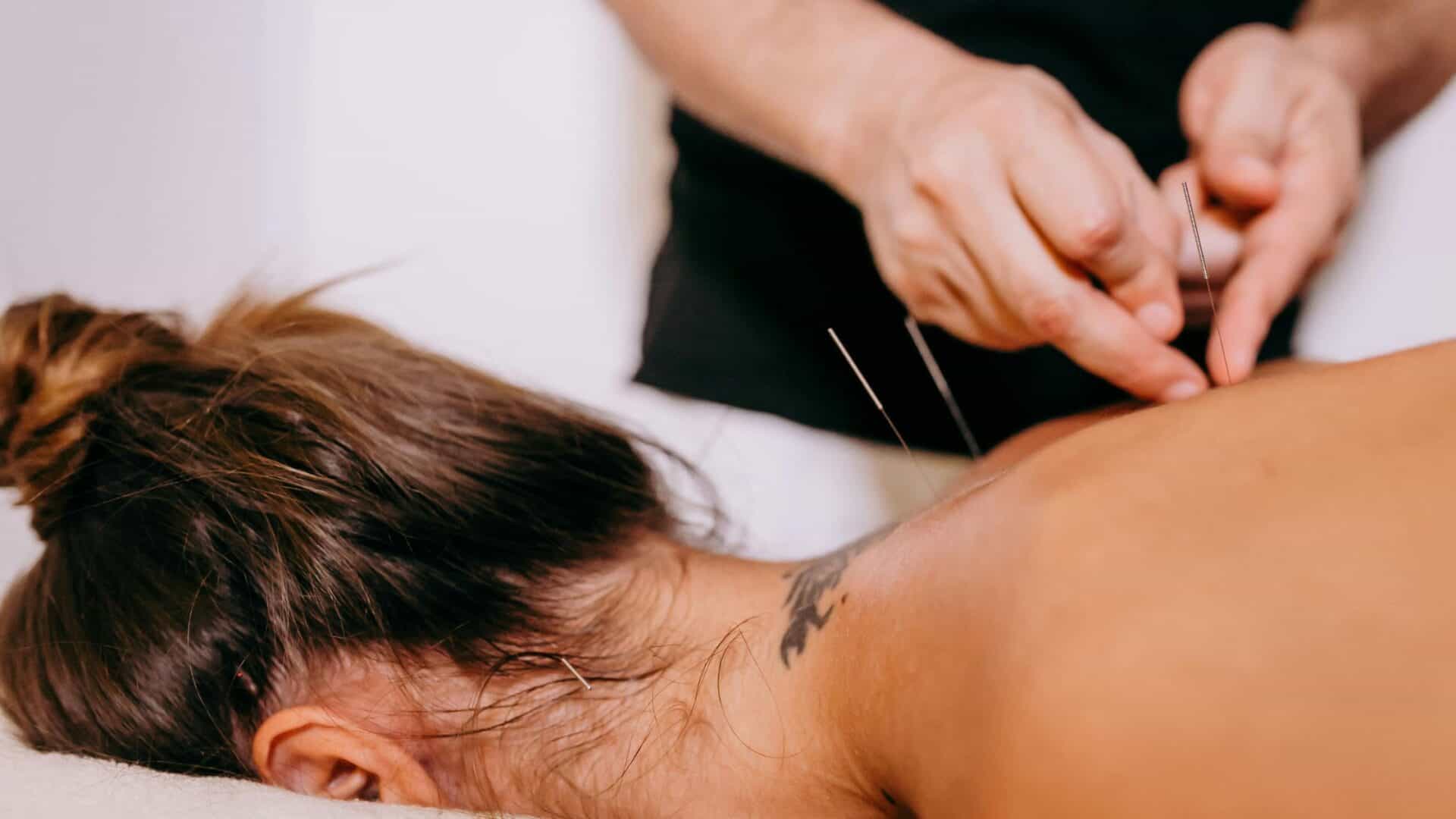 Acupuncture For Wellness Support