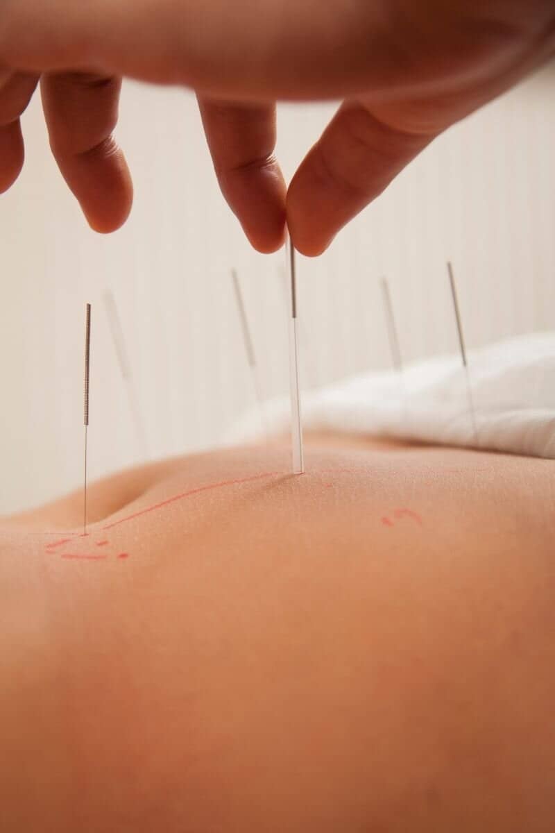 Acupuncture for Digestive Disorders Summary