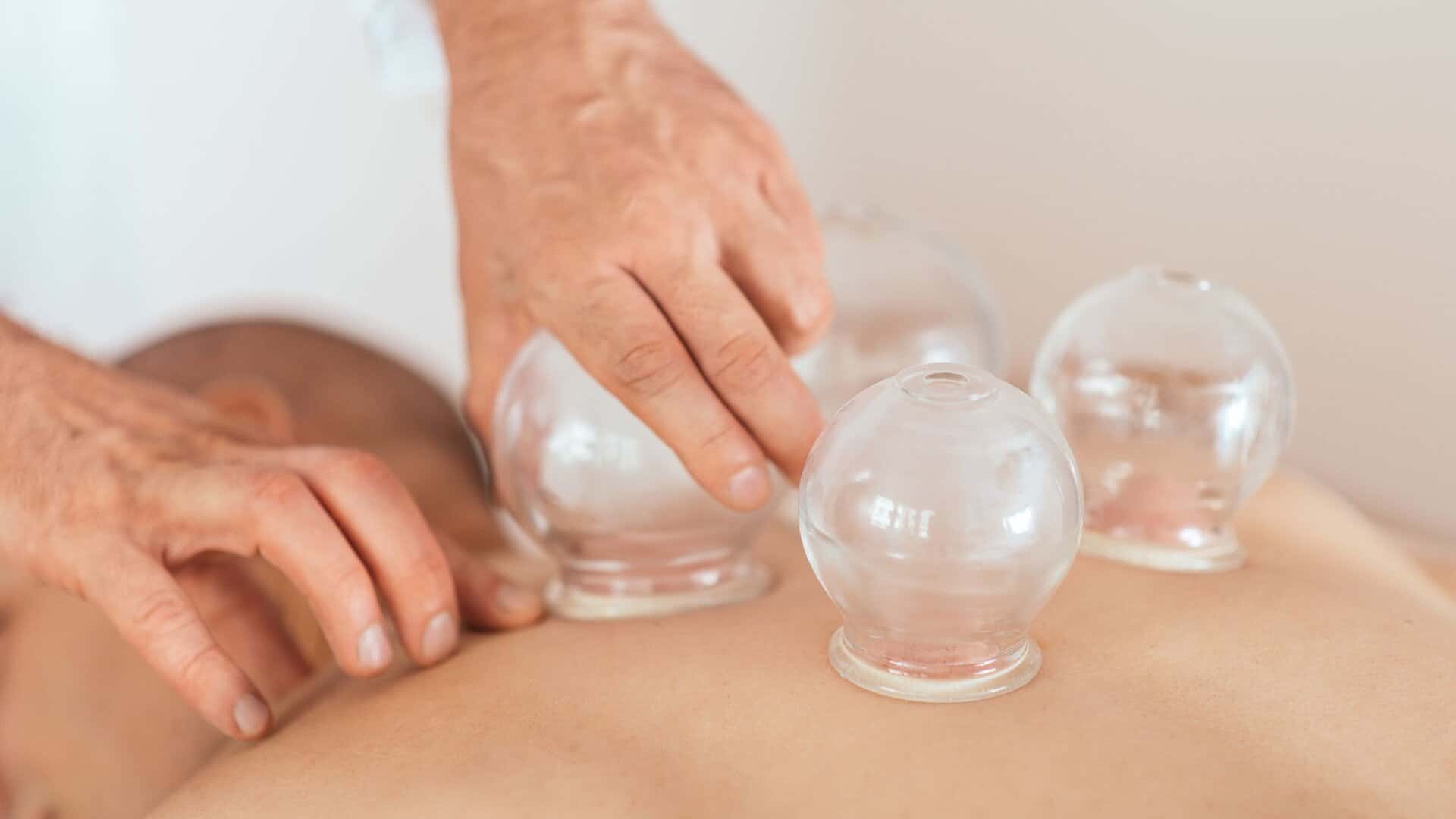 Cupping Therapy Benefits
