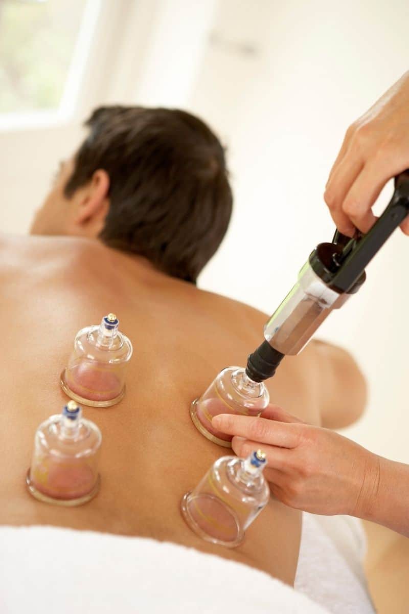 Cupping Therapy Summary