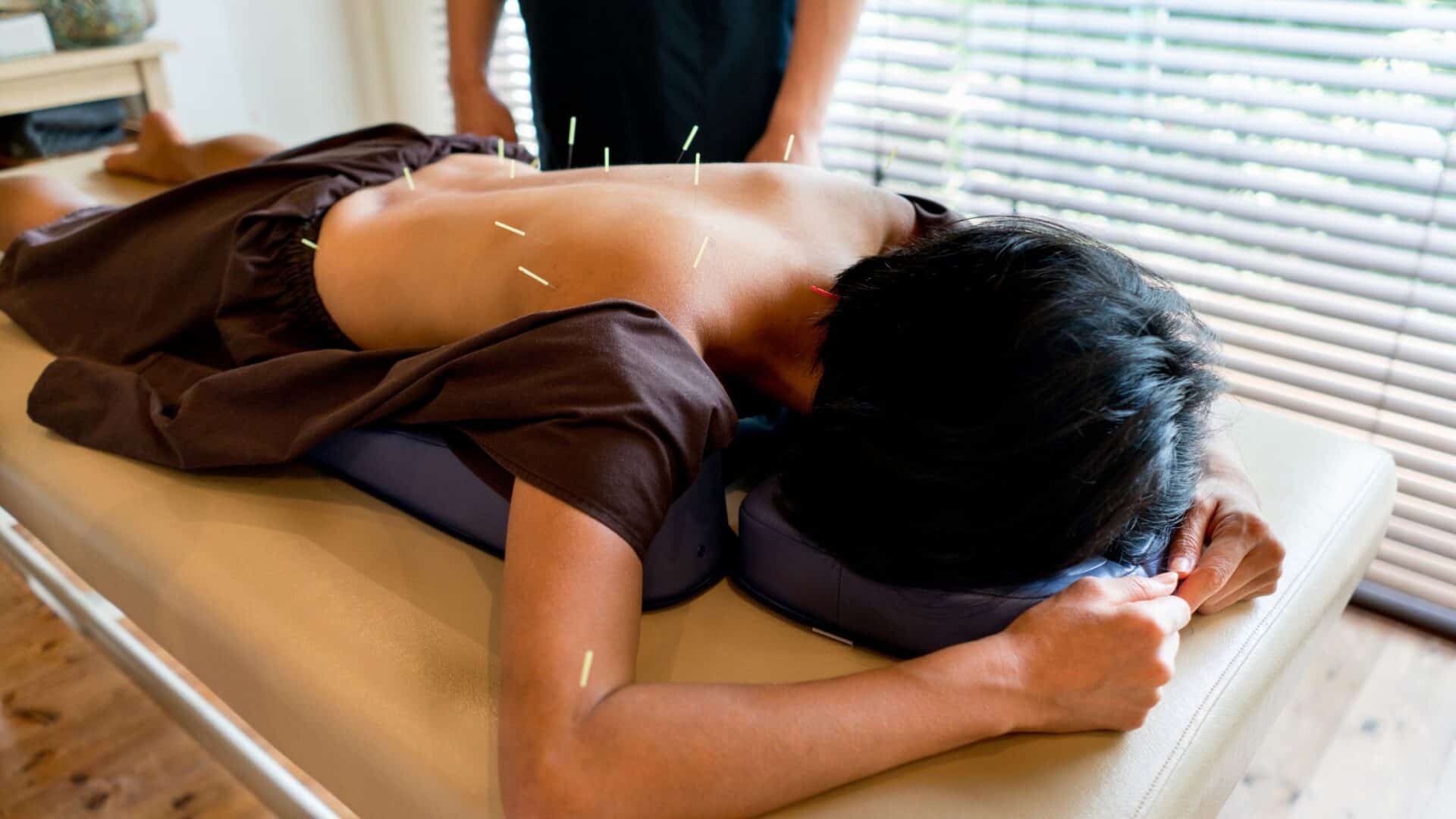 Immune System Enhancement Acupuncture